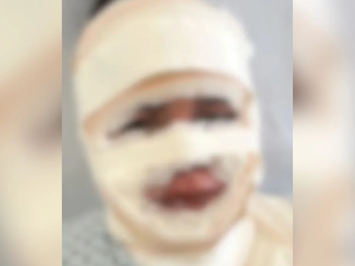 Fisioterapeuta é presa após jogar água quente em atual do ex em BH