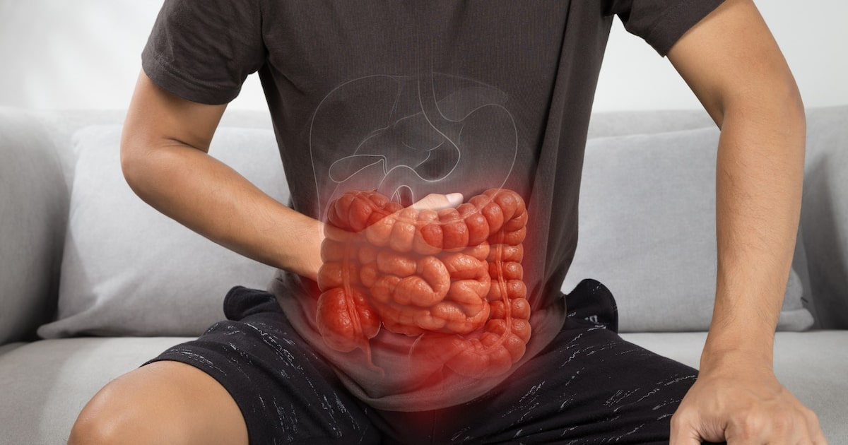 Casos de doenças inflamatórias intestinais aumentam 5 vezes em 13 anos no País; entenda por quê