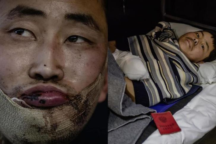 A North Korean sniper and reconnaissance officer, left, and a rifleman, captured by Ukrainian forces, receive medical treatment at an undisclosed location in Kyiv, Ukraine. Screenshots from Ukrainian President Volodymyr Zelenskyy's X account